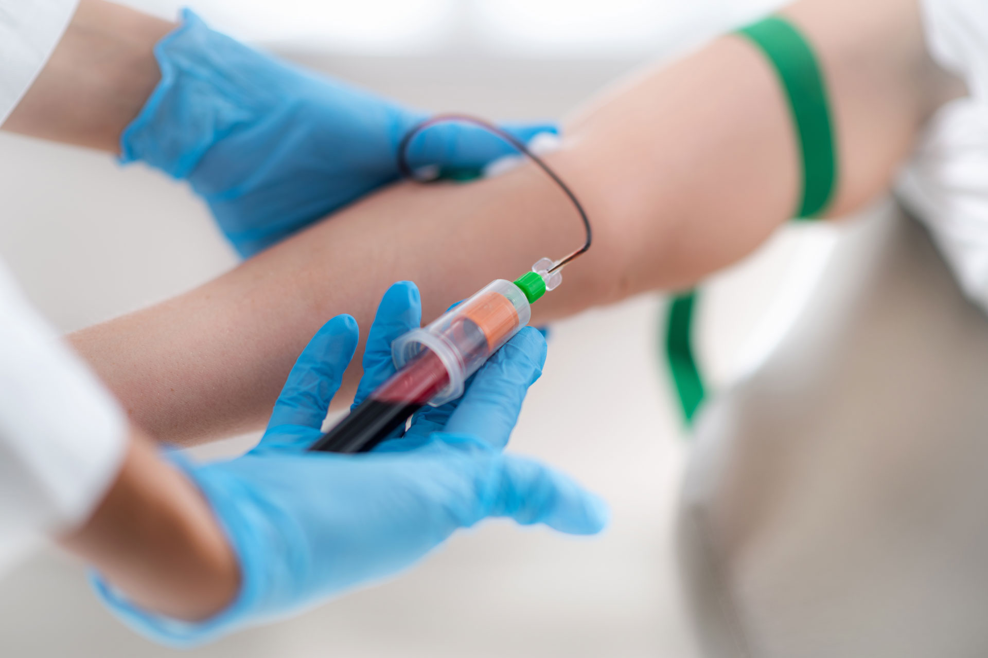 drawing-blood-for-stem-cell-therapy